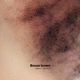 Illustration for article titled Frances New Anti-Domestic Violence Ads Are Pretty Jarring
